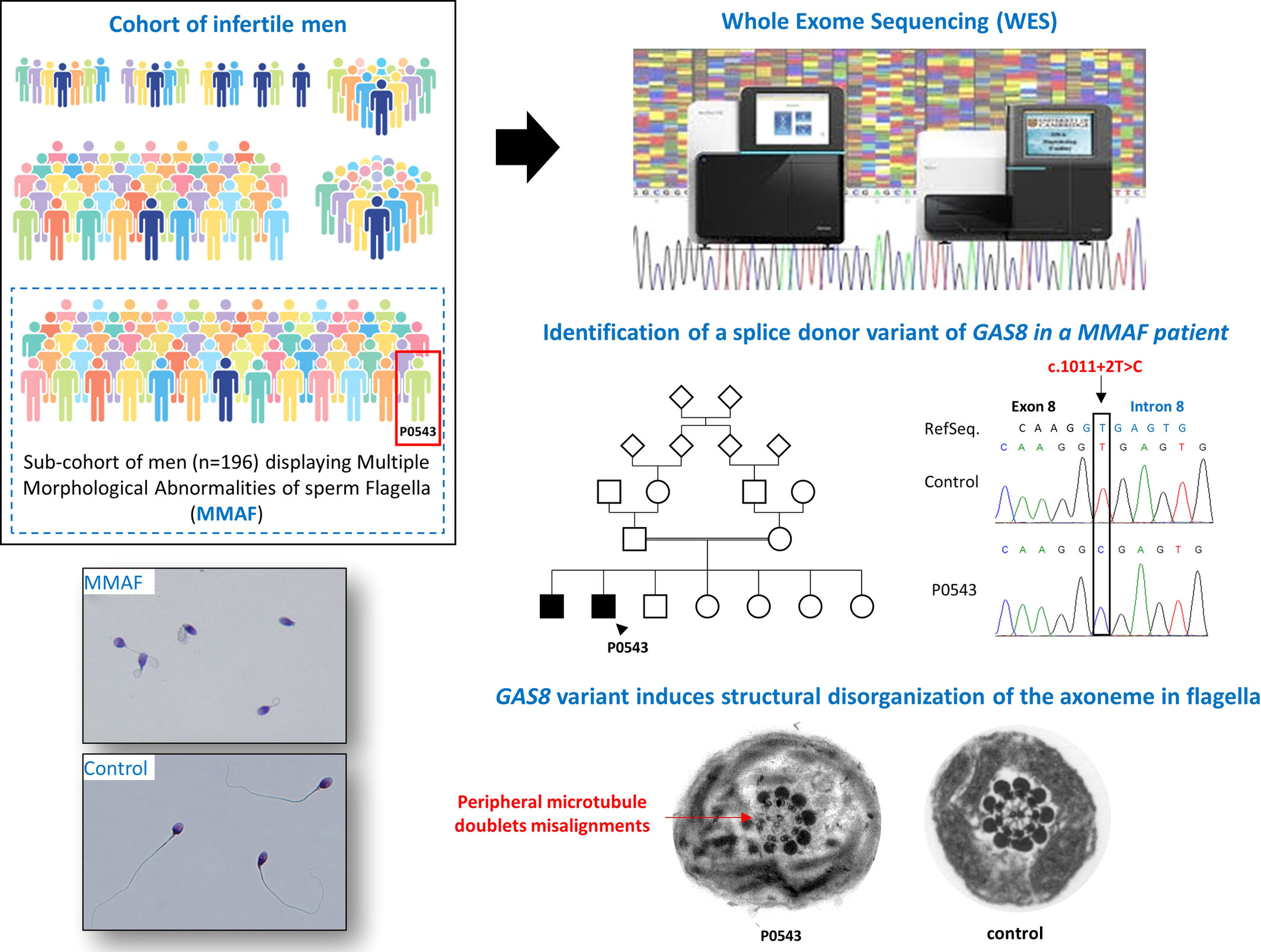 A splice donor variant of GAS8 induces structural disorganization of the axoneme in sperm flagella and leads to nonsyndromic male infertility
