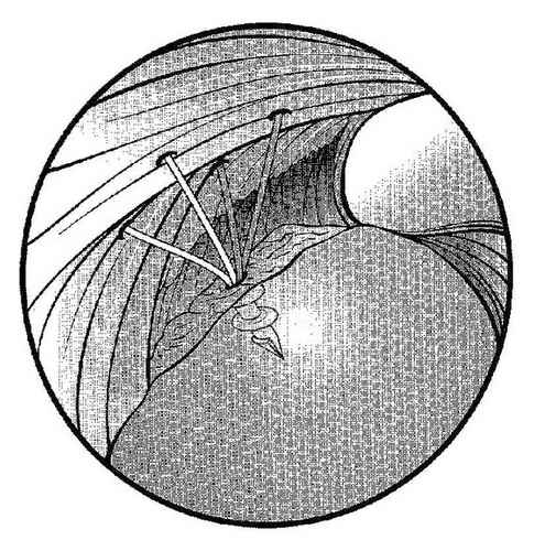 Details are in the caption following the image
