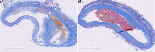 Details are in the caption following the image