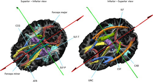 Details are in the caption following the image Details are in the caption following the image
