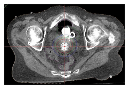 Details are in the caption following the image Details are in the caption following the image
