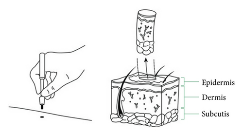 Details are in the caption following the image