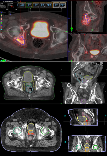 Details are in the caption following the image Details are in the caption following the image
