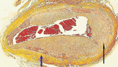 Details are in the caption following the image