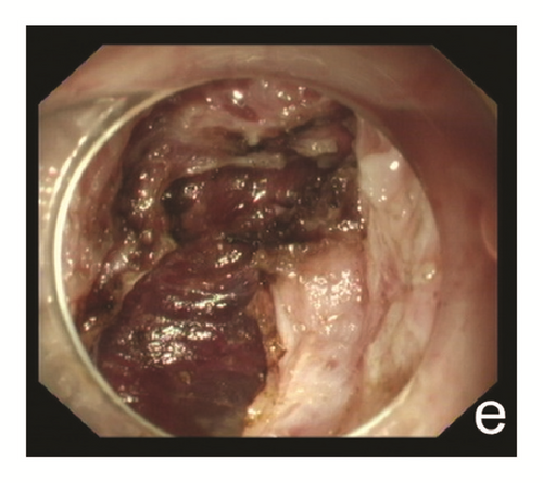 Details are in the caption following the image Details are in the caption following the image