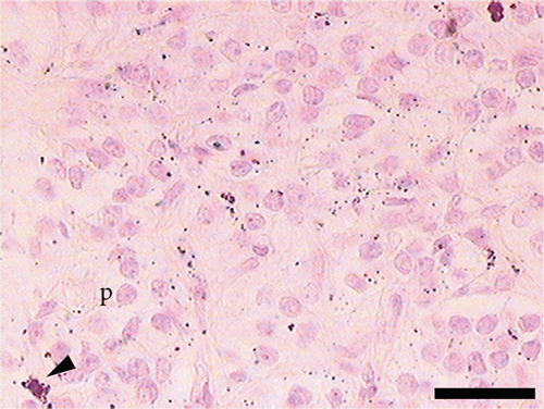 Details are in the caption following the image