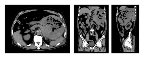 Details are in the caption following the image Details are in the caption following the image