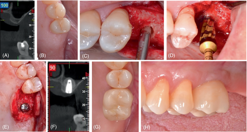 Details are in the caption following the image Details are in the caption following the image