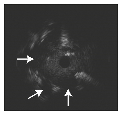 Details are in the caption following the image Details are in the caption following the image