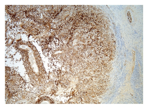 Details are in the caption following the image