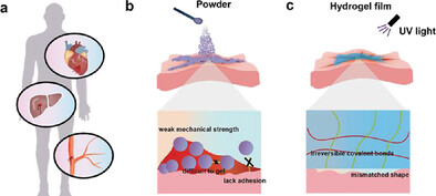 Ultrafast Self-Gelling, Adhesive, Anti-Bacterial Coacervate-Based Powders for Enhanced Hemostasis and Wound Healing