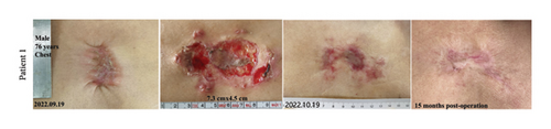Details are in the caption following the image Details are in the caption following the image