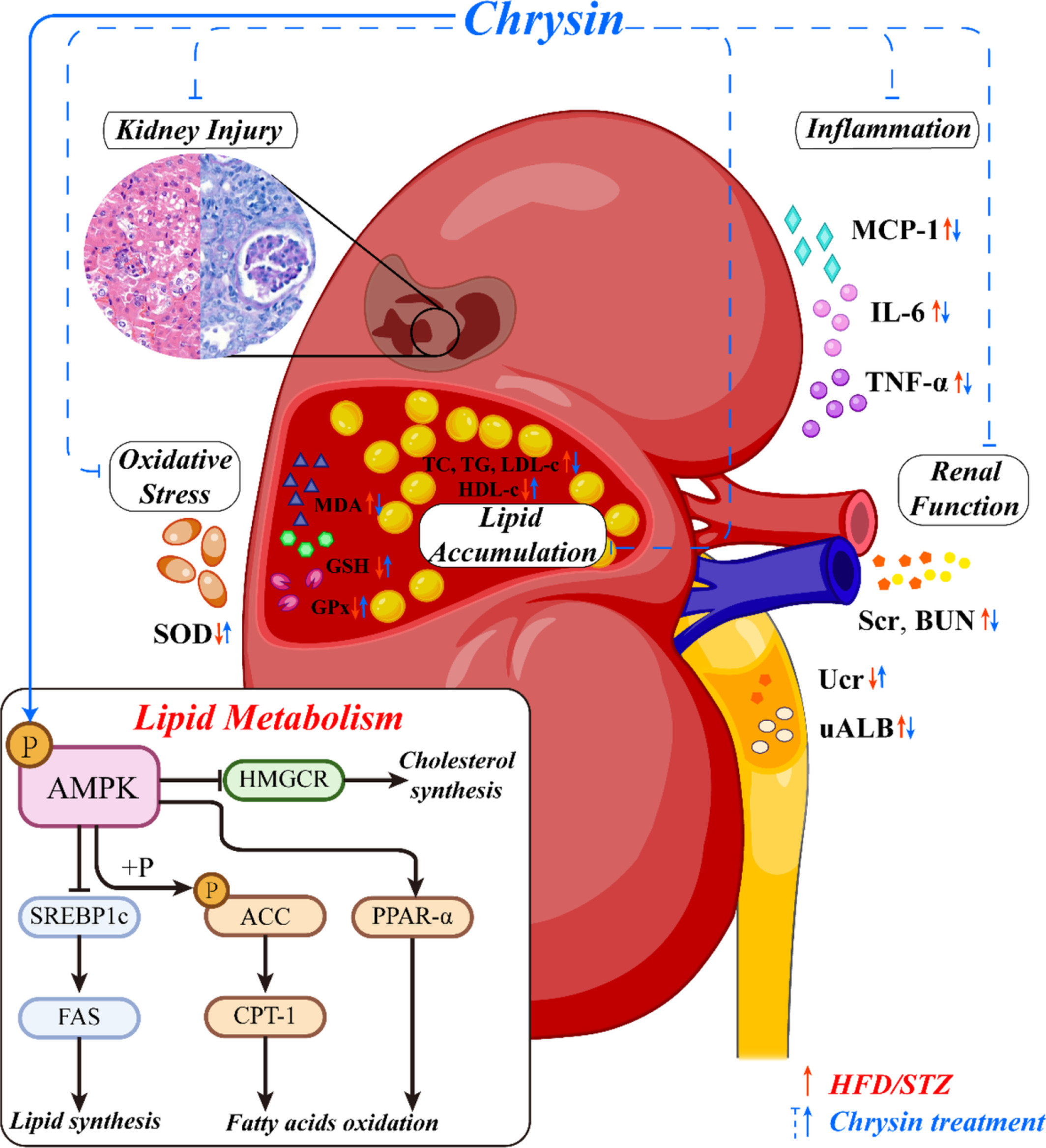 Chrysin improves diabetic nephropathy by regulating the AMPK-mediated lipid metabolism in HFD/STZ-induced DN mice