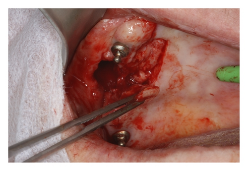 Details are in the caption following the image Details are in the caption following the image