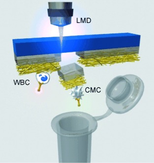 Polymer Nanofiber-Embedded Microchips for Detection, Isolation, and Molecular Analysis of Single Circulating Melanoma Cells