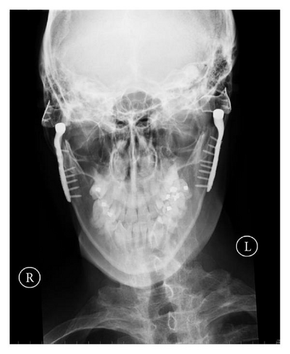 Details are in the caption following the image Details are in the caption following the image