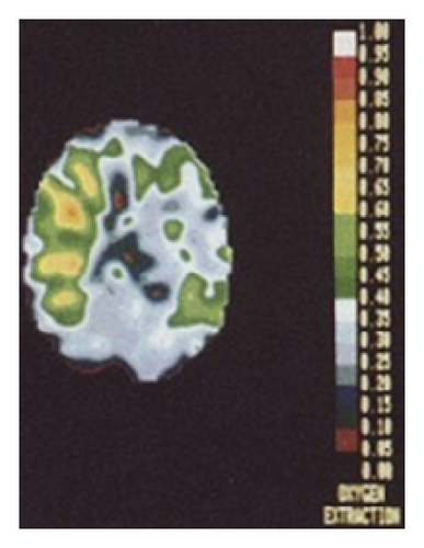Details are in the caption following the image