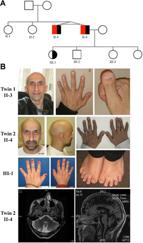 Details are in the caption following the image Details are in the caption following the image