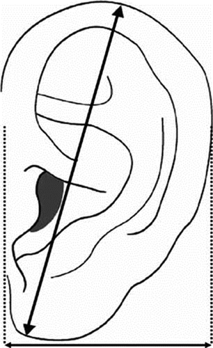 Details are in the caption following the image
