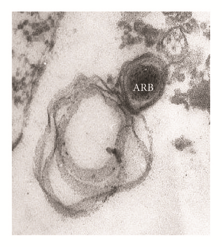 Details are in the caption following the image
