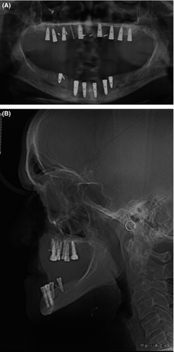 Details are in the caption following the image