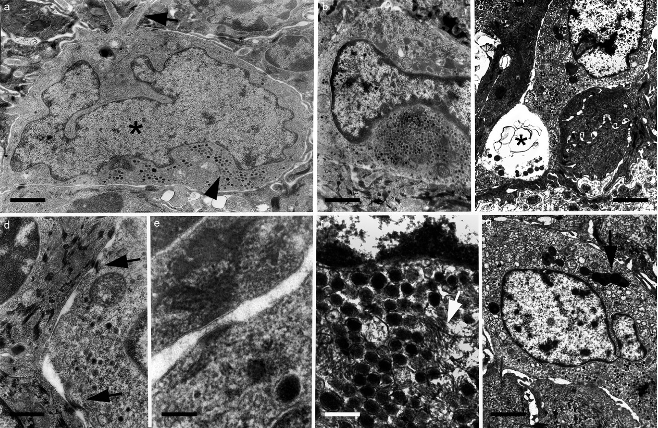 Ultrastructural characterization of normal Merkel cells in the dog