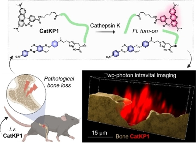 Real-Time Live Imaging of Osteoclast Activation via Cathepsin K Activity in Bone Diseases