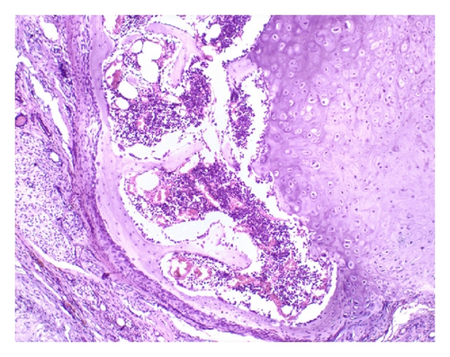 Details are in the caption following the image