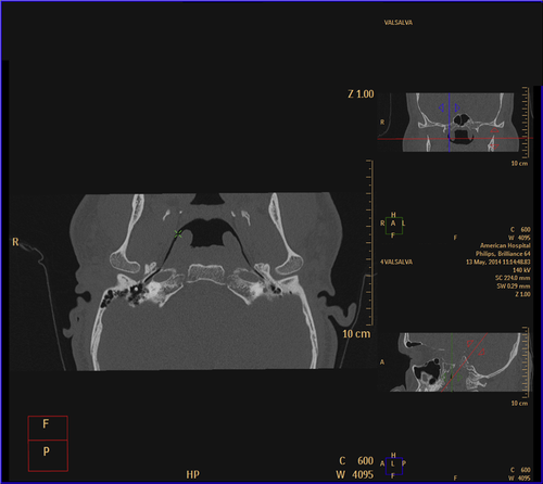 Details are in the caption following the image Details are in the caption following the image