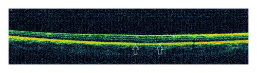 Details are in the caption following the image