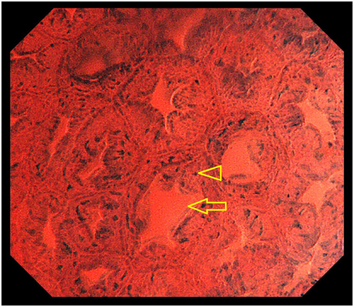 Details are in the caption following the image Details are in the caption following the image