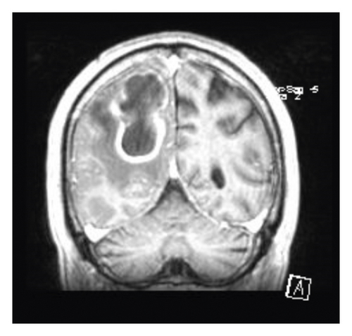 Details are in the caption following the image