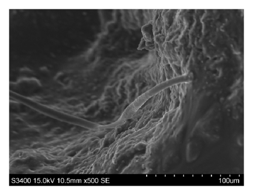 Details are in the caption following the image