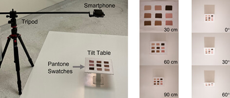 Effect of camera distance and angle on color of diverse skin tone-based standards in smartphone photos