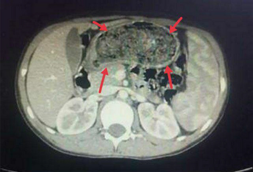 Details are in the caption following the image Details are in the caption following the image