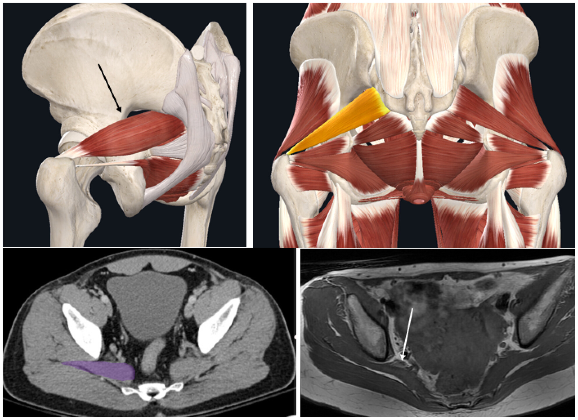 Collaborative use of a 3D anatomy platform to motivate and enhance anatomy learning in first-year online medical sonography students