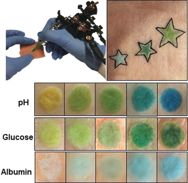 Dermal Tattoo Biosensors for Colorimetric Metabolite Detection