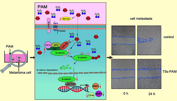 Low-temperature plasma-activated medium inhibited invasion and metastasis of melanoma cells via suppressing the Wnt/β-catenin pathway
