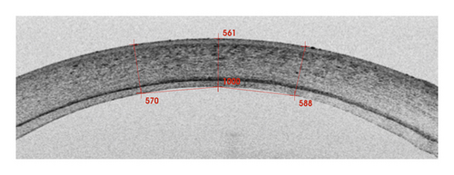 Details are in the caption following the image