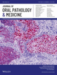 Journal of Oral Pathology & Medicine
