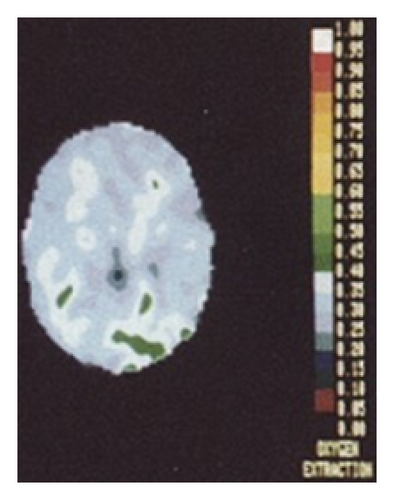 Details are in the caption following the image