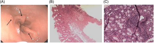 Details are in the caption following the image Details are in the caption following the image