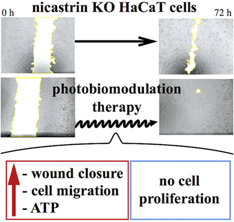 Photobiomodulation therapy promotes in vitro wound healing in nicastrin KO HaCaT cells