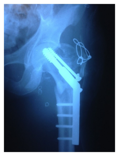 Details are in the caption following the image
