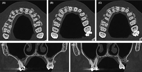Details are in the caption following the image Details are in the caption following the image