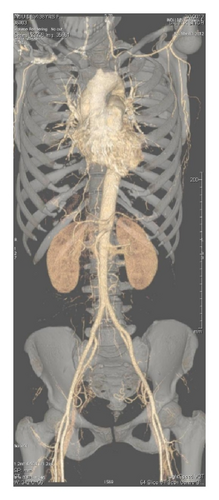 Details are in the caption following the image