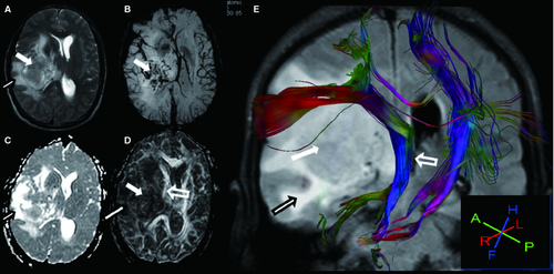 Details are in the caption following the image Details are in the caption following the image