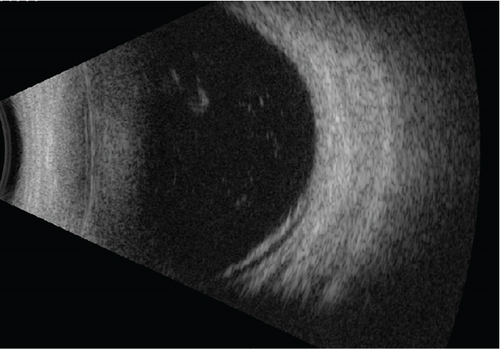 Details are in the caption following the image