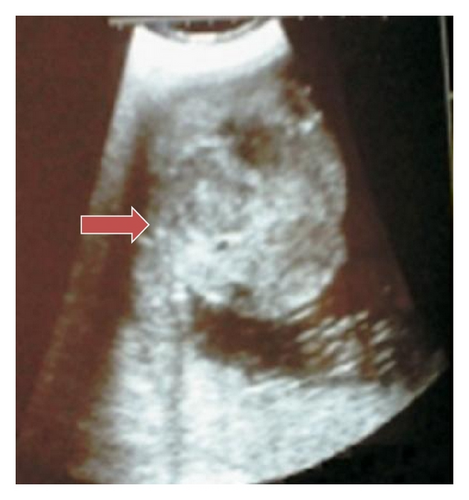 Details are in the caption following the image
