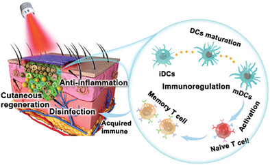 Photoresponsive Bio-Heterojunctions Eliciting Immunogenicity to Prevent Infection Recurrence and Accelerating Chronic Wound Regeneration